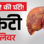 अगर स्किन पर नजर आएं 3 लक्षण, तो समझ जाएं फैटी हो गया है लिवर;